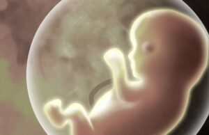 From Kermit Gosnell’s crimes to signs of hope, reflecting on life and choice